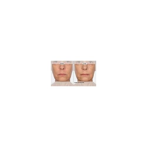 Signature Club A 5 Essentials Creme for Face and Eyes with Plant Stem Cell Complex