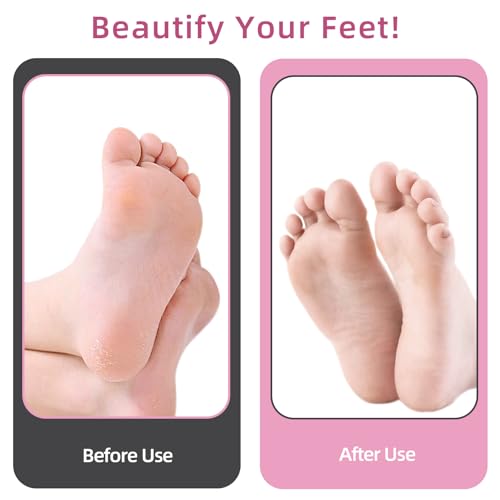4.8IN Longer Electric Foot Callus Remover with 80pcs Sandpaper Discs, Professional Aluminum Callus Remover for Feet, Stepless Speed Control Pedicure Tools for Dead Skin (Pink)