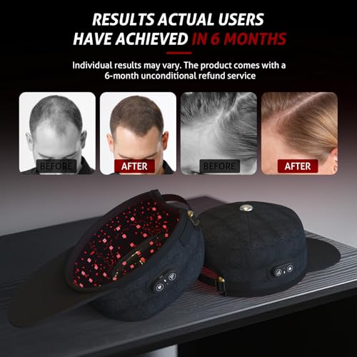 Laser Cap, Laser Red Light Therapy for Hair Growth System, Hair Thinning & Alopecia Treatment for Men & Women, Laser Cap for Hair Regrowth Stimulates Denser Fuller Hair