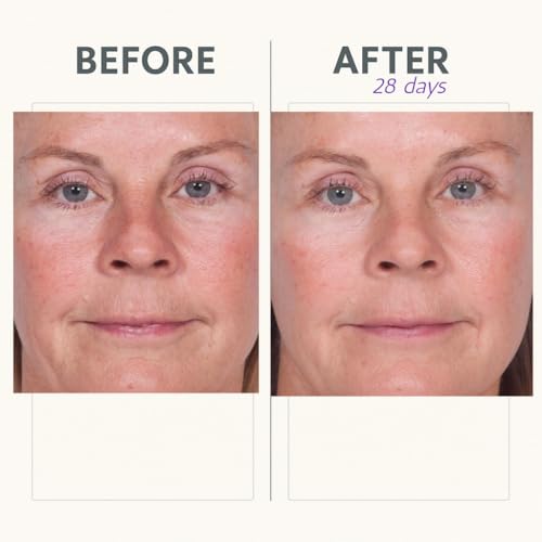 Reverse Lift Firming Facial Serum, Visibly Firm, Tone & Tighten Skin, Hydrating Anti-Aging Peptides, Reduce Wrinkles, Sagging Face and Neck, Serious Skincare, 1 oz