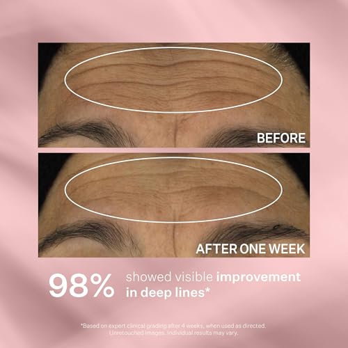 StriVectin Anti-Wrinkle Face Creams and Serums, with Ceramides & Peptides for Firm Skin and Less Wrinkles & Fine Lines