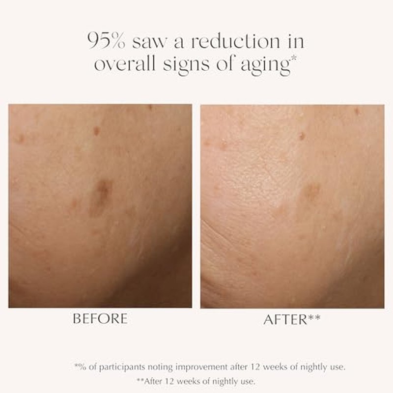 EXUVIANCE AGE REVERSE+ Advanced Renewal Retinol Overnight Serum Anti-Aging Wrinkle Reducer with 0.3% Pure Retinol, Niacinamide, NeoGlucosamine, Hyaluronic Acid, & Centella Asiatica, 30ml/1 fl oz