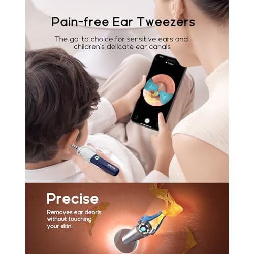 Earsight Plus I35R Ear Wax Removal Tool with Camera | Smart Visual Ear Cleaner with Gentle Tweezers & 12 Tips, HD Otoscope for Adults & Kids