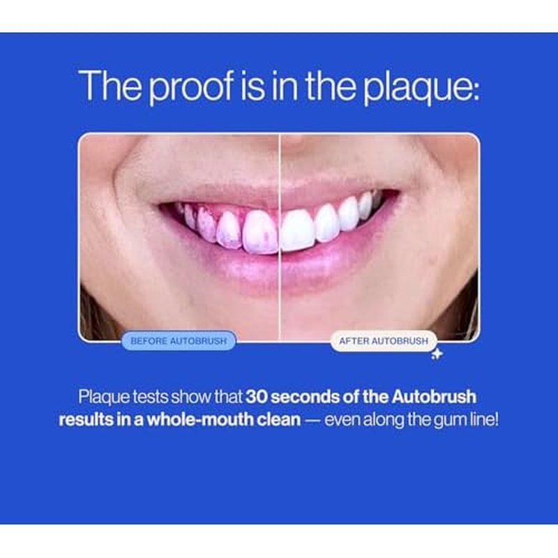 autobrush Sonic Pro Electric Toothbrush ? Only ADA Accepted U-Shaped Brush, Clinically Proven Up to 5.1X Better Cleaning, 30-Second Full Mouth 360 Clean, Rechargeable, Waterproof, Black, Men's Regular