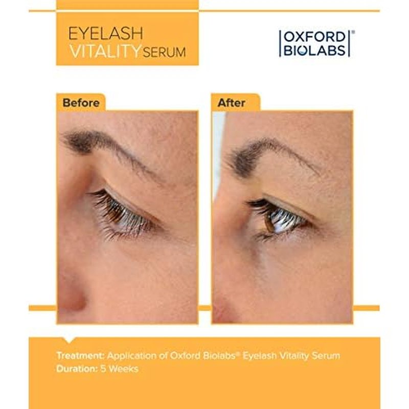 Eyelash Vitality Growth Serum - Lash Enhancing Growth Serum Complex - Irritation Free - Hypoallergenic Naturally-based Turmeric Growth, Achieve Longer Thicker & Healthier Lashes, 3.5 ml