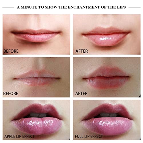 Electric Lip Plumper Tool, Lip Plumper Device, Physical Movement Lip Enhancer Plumper Tool, Lip Suction Plumper Mouth Tool 450mAh White