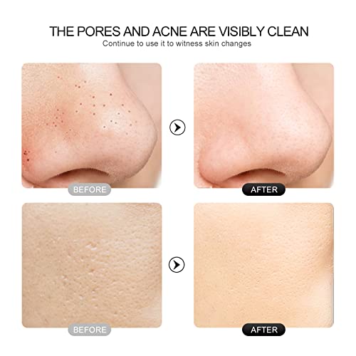 Face Scrubber Skin Spatula - Blackhead Remover with 4 Modes, Pore Extractor Face Spatula Deep Cleansing for Facial Skincare Women Gift