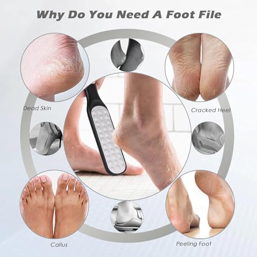 2 Pack Pedicure Foot Files Callus Remover with Double Sided Feet Rasp for Dead Skin. Can be Used on Both Wet and Dry feet (Black & White)