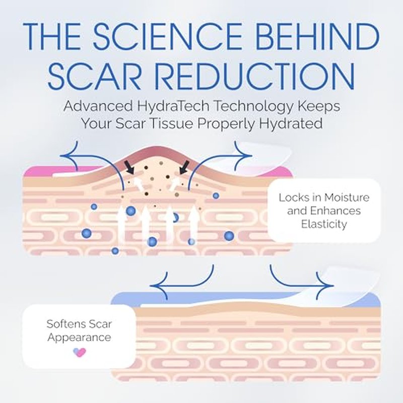 C Section Scar Silicone Strips for Surgical Scars, Tummy Tuck, and Postpartum Recovery - Tape for Scars - Reusable Silicone Scar Sheets - C Section Recovery Must Haves - Large 7-Inch Size, 8-Pack
