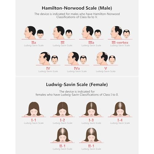 Red Light Therapy for Hair Growth, Laser Hair Growth Cap for Hair Loss, Rechargeable Battery- FDA Cleared Hair Growth for Men & Women, Wireless Red Light Hair Therapy, 162 Lasers