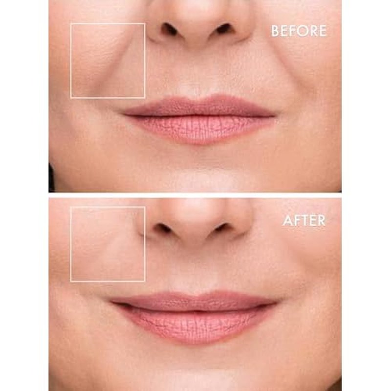 depology Deepcare+ Serum-Infused Micro Dart Patche | 4 Pairs Eye Mask | Under Eye Patches for Wrinkles | Fine Lines | Hydrating Eye Mask with Peptides | Amino Acids | and Synthesized Molecules