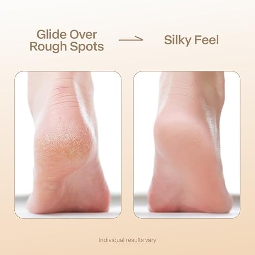 NOVAL Callus Remover Gel 250ml and Gold Handle Nano Glass Foot File Set£¬Dead Skin Remover for Feet, Exfoliating Gel for Cracked Heels and Smooth Pedicure Care