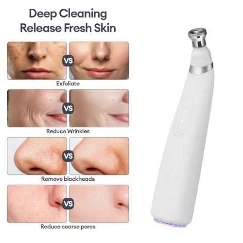 IeBilif Diamond Microdermabrasion Machine, 3 Modes Diamond Microdermabrasion Dermabrasion Machine for Blackhead Removal, Professional Portable Home Travel Microdermabrasion Device