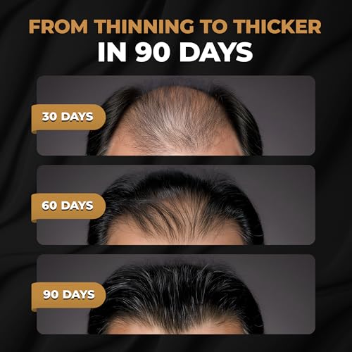 SPARTAN¢â Root Activator Conditioner For Men - Hair Growth Conditioner, Thickening Hair Moisturizer for Hair Loss and Thinning Hair