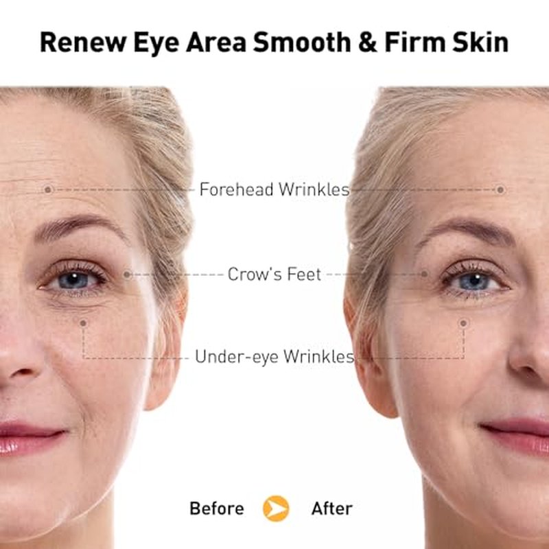Retinol Eye Cream for Anti-Aging & Wrinkles ? Firming, Hydrating & Repairing Eye Serum with Niacinamide, Hyaluronic Acid, Vitamin E & Bifida Ferment Lysate, 0.7 Fl Oz (Pack of 1)