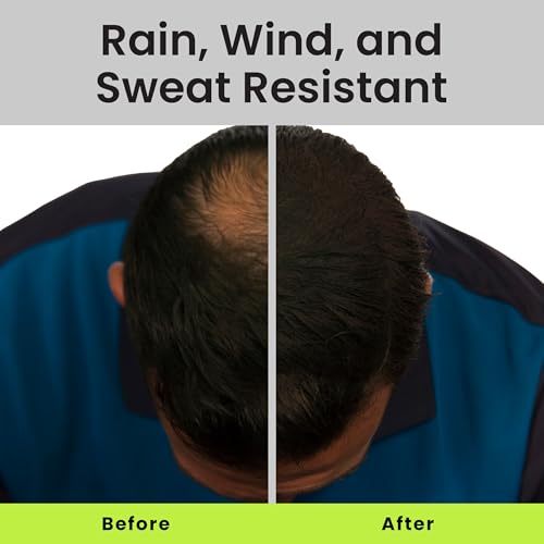 ECLIPSE Hair Fibers Dark Brown for Thinning Hair for Women & Men to Conceal Hair Loss in 15 Seconds - 100% Undetectable Hair Building Fibers, 15g