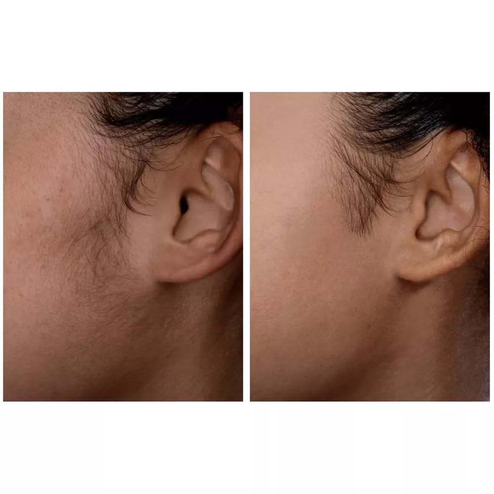 Spa Sciences SIMA DELUXE - Dermaplaning Tool for Painless Facial Exfoliation & Peach Fuzz Removal - 14 Weeks of Treatment Included