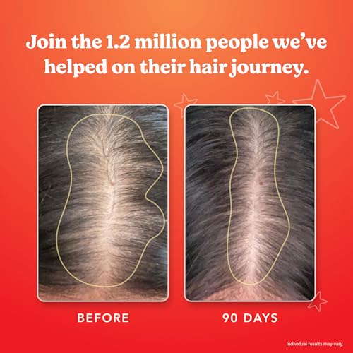 HAIRtamin Advanced Formula Hair Vitamins, Growth Supplement for Women & Men, Supports Stronger, Longer, Visibly Thicker Hair, With 5000 mcg Biotin, Vitamins & Antioxidants, 100% Vegan - 1 Month Supply