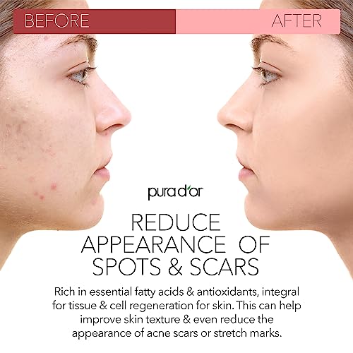 PURA D'OR ORGANIC Rosehip Seed Oil Hair Relaxer (4 Oz x3 = 12 Oz) 100% Pure Cold Pressed USDA Certified All Natural Anti-Aging, Scar Treatment, Gua Sha Massage, Face, Hair & Skin - Women & Men