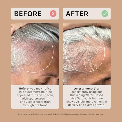 ACTIIV Thickening Hair Serum - Oil Based | Supports the Appearance of Thicker, Fuller-Looking Hair, for Textured & Curly Hair, Deeply Nourishes & Strengthens Roots, Non-Greasy, All Hair Types, 1.8 oz