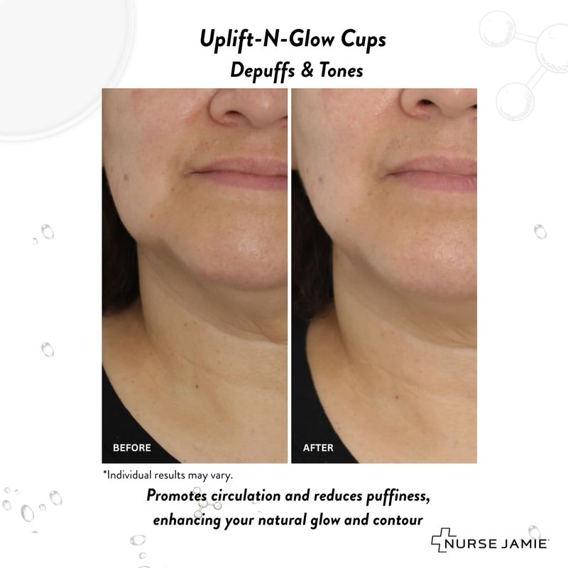 Nurse Jamie Uplift-N-Glow Facial Cupping Tool – Silicone & Glass Cups for Facial Drainage, Product Absorption & Skin Revitalization