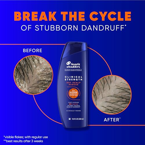 Head & Shoulders Clinical Dandruff Defense + Dry Scalp Rescue Shampoo