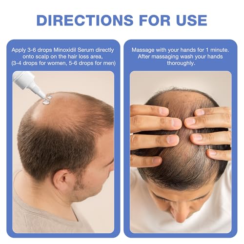 5% Minoxidil for Men, for Men & Women Hair with Biotin, Minoxidil for Beard Growth for Hair Loss to Hair Regrowth Get Thicker Fuller, Hair Loss Treatments for Women 100ml