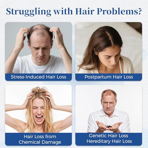 Hair Growth Serum Roll On 25ml with Saw Palmetto, Rosemary & Pea Extract£¬Helps Support Thicker, Fuller Hair Appearance£¬Clean, Non-Greasy Hair Loss Support for Men & Women Pack of (1)