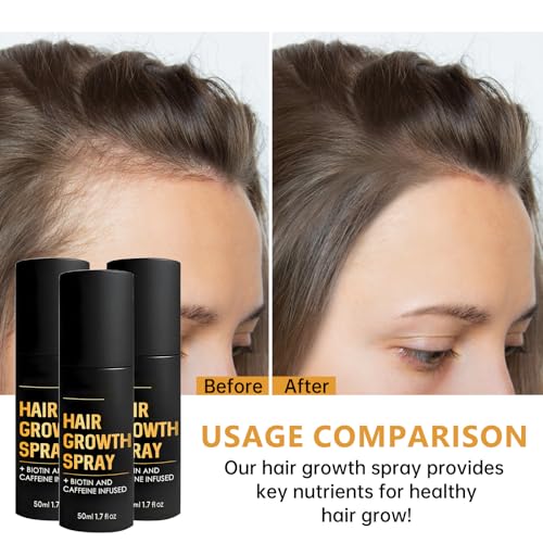 Halo Grow Hair Growth Spray, Hair Thickening Spray for Fine Hair, Volumizing & Moisturizing Treatment with Natural Ingredients, For Men & Women, 1.7 Fl Oz