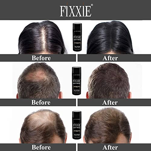 Hair Building Fibers DARK BROWN for Thinning Hair 27.5g Bottle, Hair Fibre Concealer for Hair Loss for Men and Women, Naturally Thicker Looking Hair with Keratin Hair Fibres