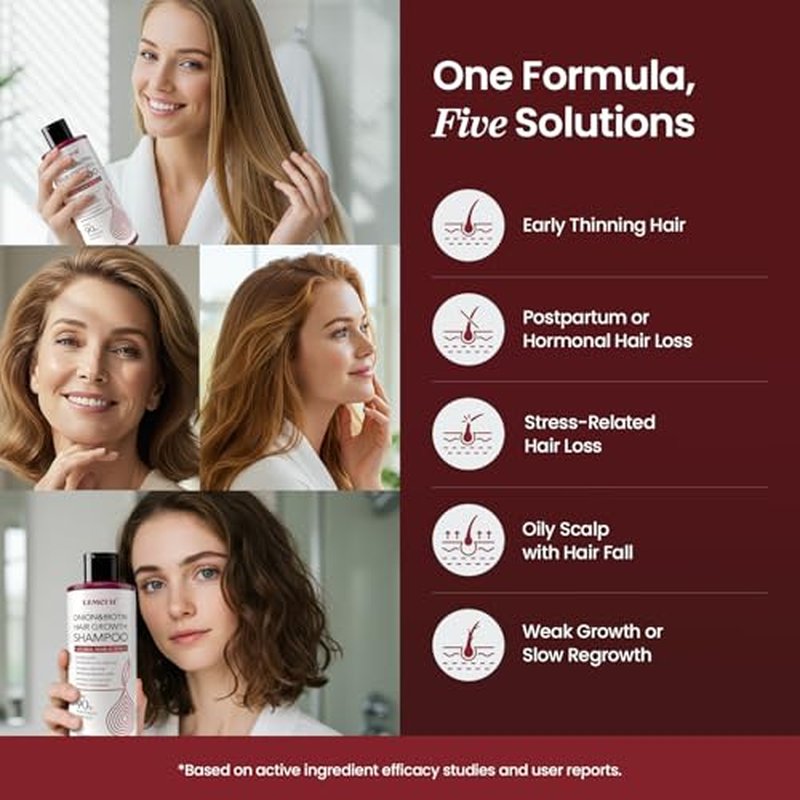 Onion & Biotin Hair Growth Shampoo: Infused With Natural Rosemary Tea Tree Oil Anti Hair Loss Shampoo - Scalp Smooths Thickening Formula Support Hair Regrowth For Women Men (12.5 Fl Oz)