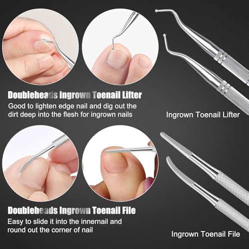 7-Piece Ingrown Toenail Treatment Set, Professional Stainless Steel Ingrown Toenail Removal Kit, Calloused Feet Remover Tool, Manicure Treatment Pedicure Tools for Feet (Under-Nail Clean + Foot Care)