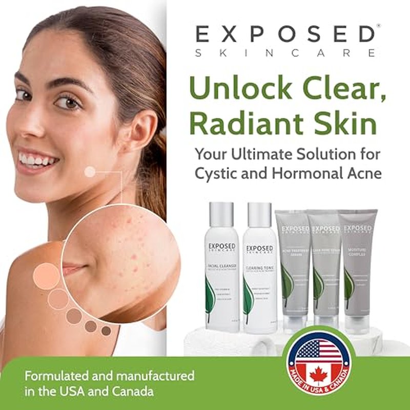 Exposed Skin Care, Expanded Acne Treatment Kit with 2.5% Salicylic Acid and 3.5% Benzoyl Peroxide to Clear Up Teen, Adult, Hormonal and Cystic Acne ? Natural, Non-toxic and Cruelty Free