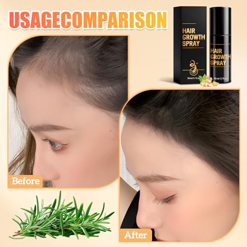 Hair Growth, Hair Growth Spray, Promotes Thicker, Fuller Hair, Suitable for All Hair Types, Hair Thickening Spray with Natural Ingredients (1 Count)
