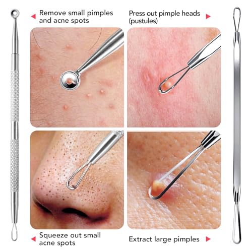 Litbear 6 Pcs Blackhead Remover Tools,Pimple Popper Tool Kit,Blackhead Pimple Comedones Extractor,Acne Tools Extractor kit, Scraper for Face Nose Deep Cleansing with Leather Case