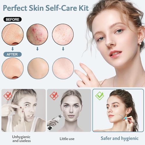 Blackhead Remover Tools MENOLY 10Pcs Pimple Popper Tool Kit, Blackhead Remover Extractor Tools, Acne Kit for Blackhead,Blemish,Zit Whitehead and Comedone Extractor Tool with Leather Bag