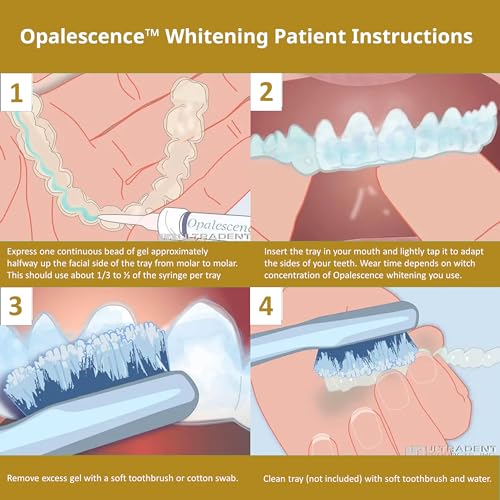 Opalescence 45% Syringes Teeth Whitening Gel - with PF - (4 Syringes) Refill Kit Carbamide Peroxide. w/Toothbrush, in Mint Flavor. Tooth Whitening 5359-2T