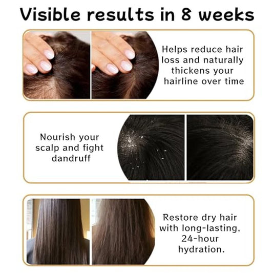 2 PCS Anti Hair Loss Shampoo, Promote Hair Growth and Thickening & Strengthening Shampoo with Various Plant Extracts for Thinning Hair Women£¨300ml£©