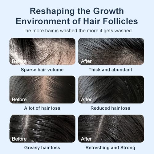 Tgideas Organic Biotin & Rosemary Hair Growth Shampoo ? Thickening Shampoo with Amino Acids for Hair Loss, Dandruff Control & Oily Scalp - for Women & Men