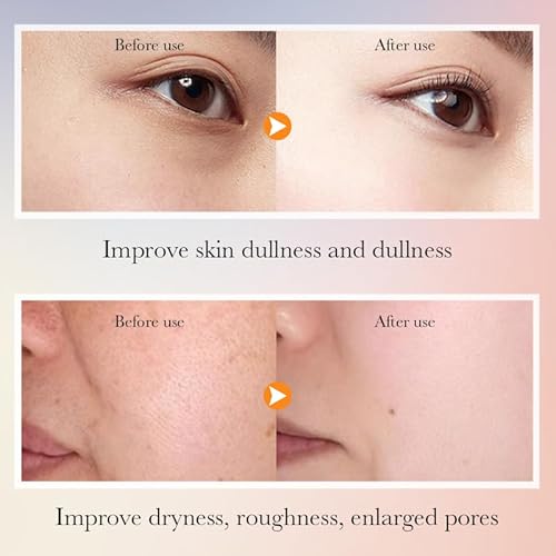 6-Piece Hydrating Skincare Set with Vitamin C & Niacinamide,Tk Face Care Kit Includes Toner, Serum,Cleanser,Moisturizer, Eye Cream & Body Lotion | Unique Gift for Women