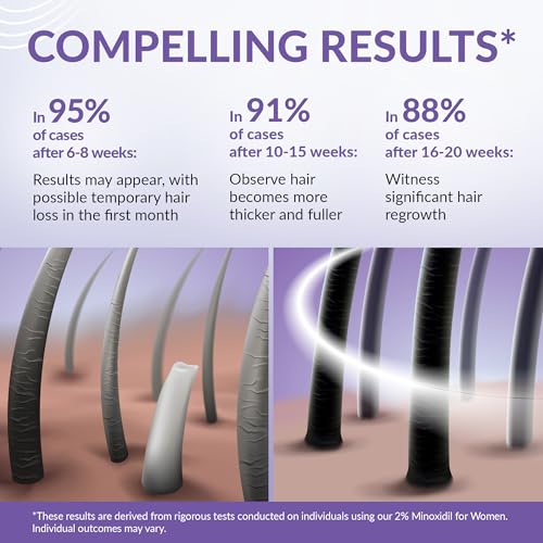 Minoxidil for Women 2% - Hair Growth Serum Women + Vitamin E, Ginseng, Ginger Extract, Biotin Hair Growth Serum - Hair Loss Regrowth & Thickening Treatment Helper