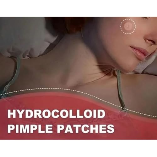 Acne Patches, 360 Count, Hydrocolloid Pimple Stickers, Breathable, Alcohol-Free, All Skin Types