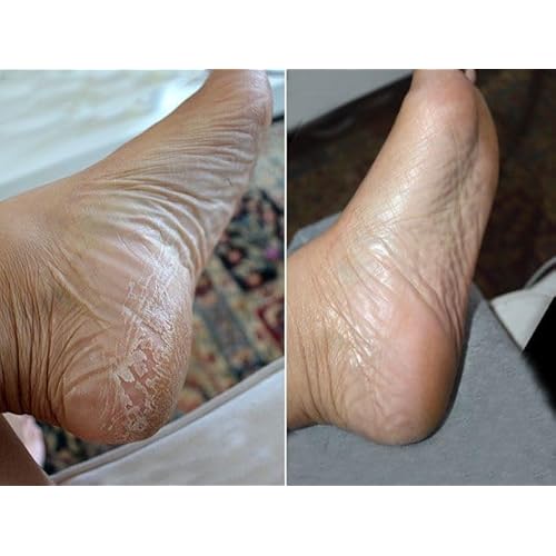 Baby Foot Spa Bundle - Original Exfoliant Foot Peel + Premium Salt Soak and 1 Foot Scrub - Baby Feet Smoothening Foot Peel, Soak and Scrub - Citrus scent - Baby Soft Foot Exfoliation Bundle Set