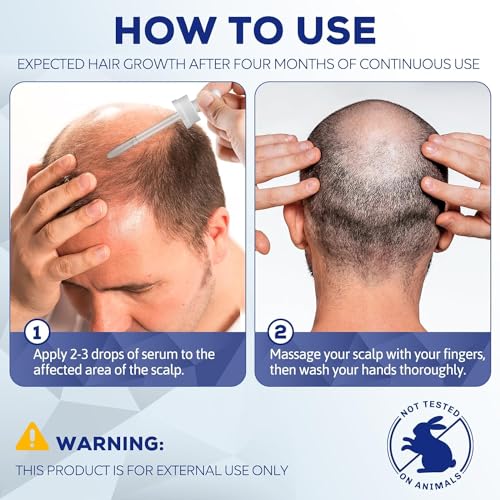 5% Minoxidil for Men and Women, Hair Regrowth Treatment for Thinning Hair and Hair Loss, Topical Solution - 1 Months Supply - Dermatologist recommended (Pack of 1)