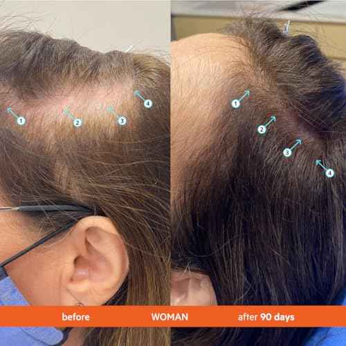 DS Labs Revita Shampoo, 205mL - Thickening Appearance, Scalp First Cleanse, Fuller Looking, Volumized Hair, Lightweight Hydration, Sulfate & Silicone Free, Color Safe, For Men & Women