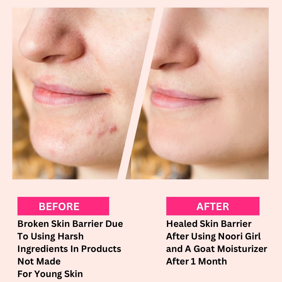 Moisturizer for Teens & Tweens - Lightweight, Fragrance-Free Face Cream for Sensitive, Acne-Prone Skin | Barrier Support, Ages 8+