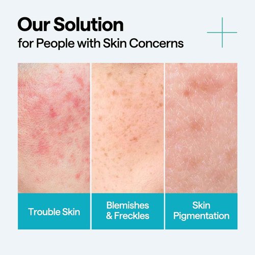 Mediheal Madecassoside Repair Serum 1.35 fl.oz - Blemish Care, Fades Pigmentation and Freckles & Skin Soothing & Hydration - with Centella Asiatica, Niacinamide