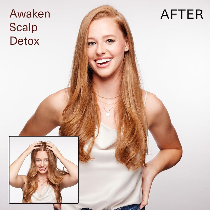 Surface Hair - Awaken Therapeutic Scalp Detox – Natural Ingredients for Thinning Hair and a Healthy Scalp - 6 floz