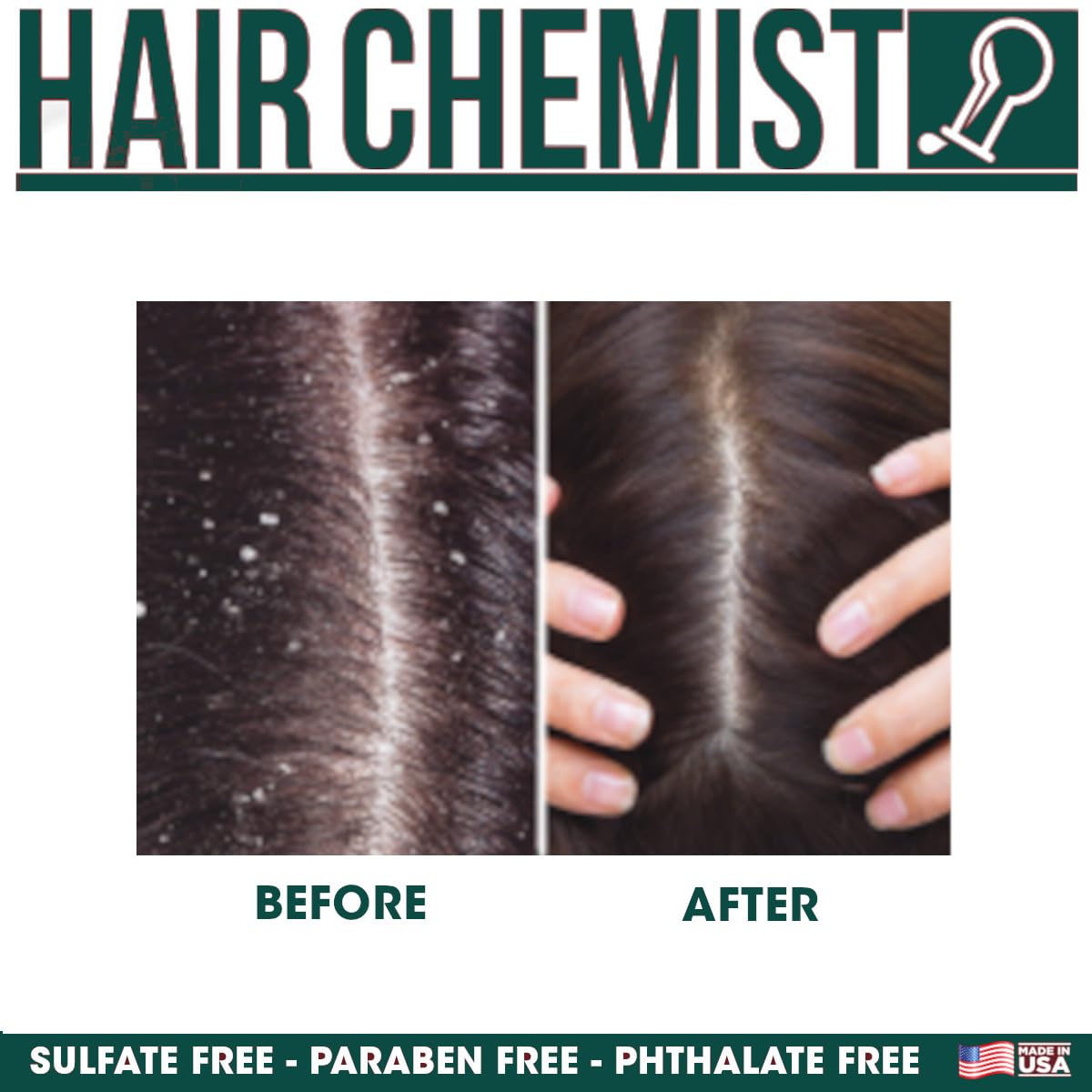 Hair Chemist Nourishing Dry Scalp & Anti-Itch Peppermint Shampoo 33.8 oz. & Conditioner 33.8 oz. 2-PC Gift Box Set - Hydrating Peppermint Shampoo & Conditioner Set, Soothes Irritated, Dry Scalp
