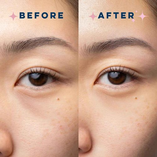 CLEAN SKIN CLUB Brightening+ Stem Cell Eye Cream, Reduces Dark Circles & Puffiness, Fragrance Free, 1.2 fl oz (Pack of 1)